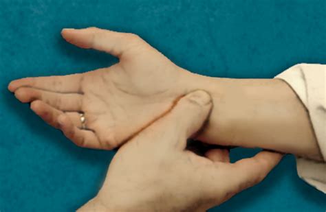 median nerve compression test|positive phalen's test.